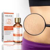 Essential Scar EELHOE Skin Repair Pregnancy and Oil Care