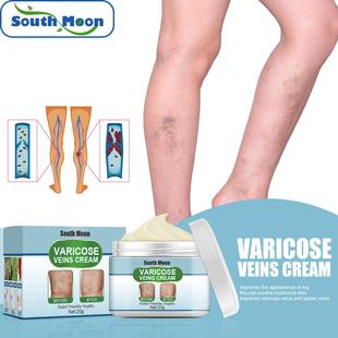 South Moon Varicose Vein Repair Cream - Alleviates the pain