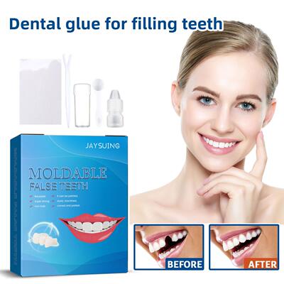 Jaysuing Mouldable Dental Putty Kit - Temporary Tooth Repair