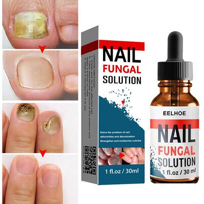 EELHOE Nail Care Solution for Hand and Foot, Thickened Formu