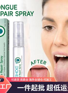 EELHOE Oral Care Spray for Repairing White Tongue Coating, R