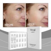 Roller and Set Face HOYGI Moisturizing for Hydration Nouris