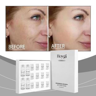 HOYGI Roller Set for Face Hydration, Moisturizing and Nouris