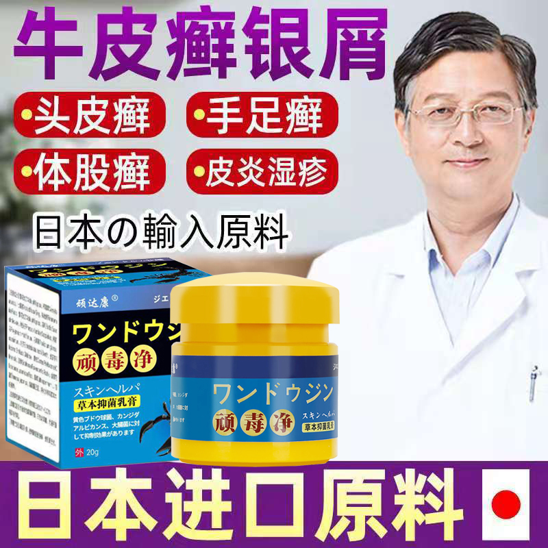 牛皮癣药膏【日本无激素】银屑湿疹专用止痒去祛根手足头外藓特效