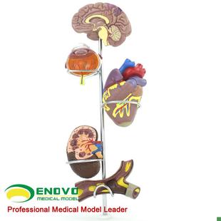 ENOVO颐诺人体医学高血压模型大脑心脏血管内科U普外科医生礼品