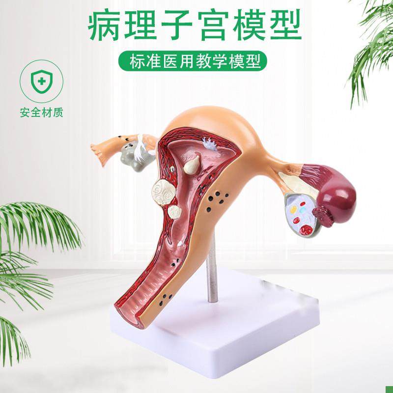 人体模型女性生殖子宫p阴道卵巢子宫教学模具病理变化科普培训教