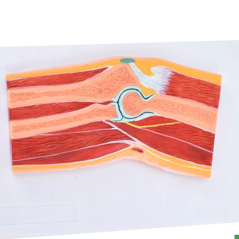 ENOVOd颐诺医学解剖肘关节骨骼肌肉模型肘关节剖面肘关节构造MRI