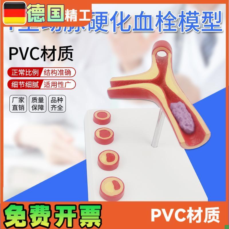德国】Y型d动脉模型硬化带血栓模型人体血管医学教学模具