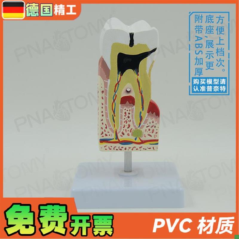 德国】人体d牙齿模型蛀牙龋齿解剖口腔科牙科教学牙神经医患沟通