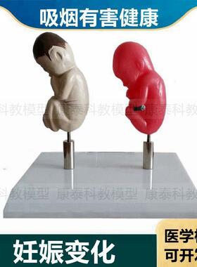 女性吸烟危害模型妊o娠胎儿禁烟科普展示戒烟教育人体内脏受损烟