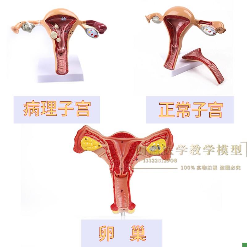 人体子宫卵巢阴道女性内外生A殖器官模型生殖科妇科医用演示