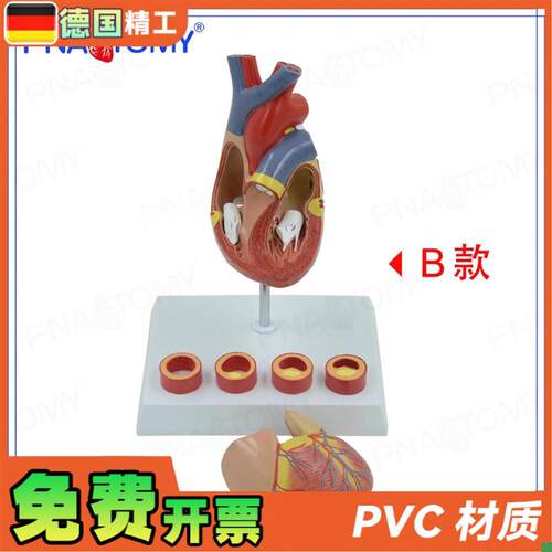 德国】PNT-0j724心脏模型4阶段血管动脉病理期心脏解剖心血管科展