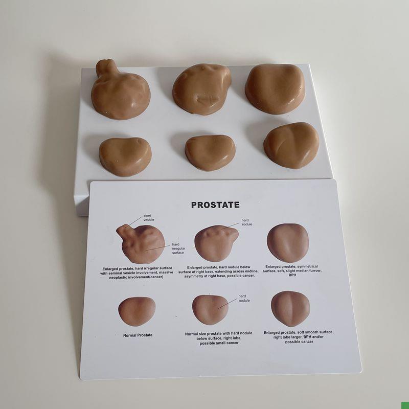 康泰前列腺模型触诊练习男科指检盆E腔泌尿生殖肛肠膀胱尿道医药