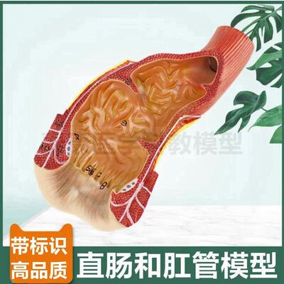 直肠模型肛管肛周末端肛肠医生用痔疮回肠盲肠阑尾大小肠病理结肠