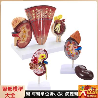 人体肾解剖模型病变肾脏模型肾单位肾小球人P体内脏器官解剖模型