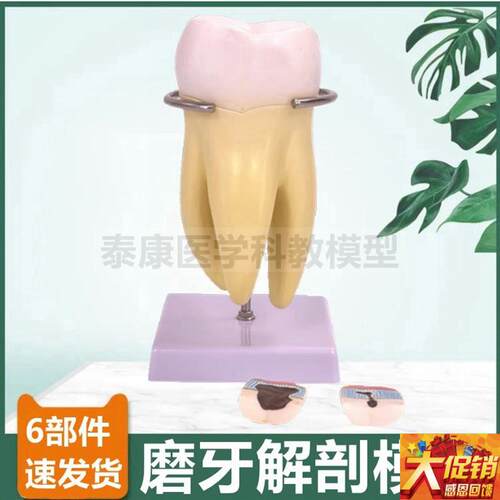 牙齿模型切牙尖牙磨牙拆卸口腔牙C医牙科教学标本龋齿蛀牙发展过