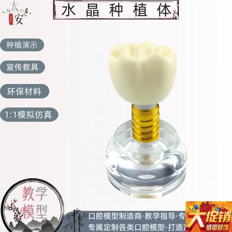 牙科口腔材料透明水晶种植体模型螺丝S可拆卸医患沟通