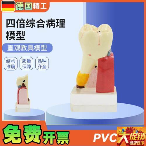 德国PNT-OR11四倍综合病理蛀牙模型牙齿病变综合U病理模型牙齿解