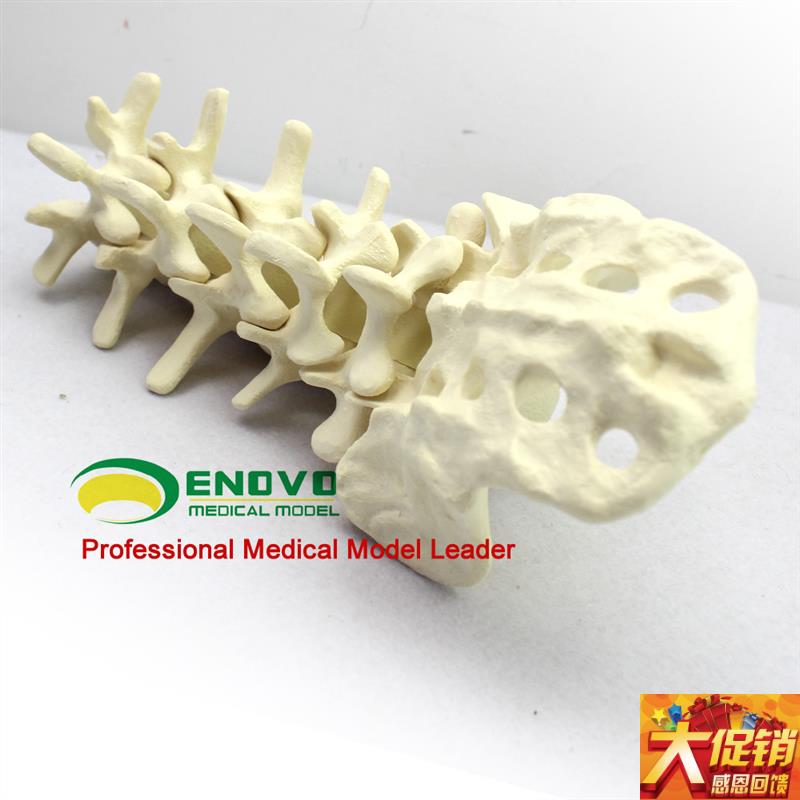 骨科术前Sagwbone人体腰椎模型人工骨模型骨科手术仿真骨演示