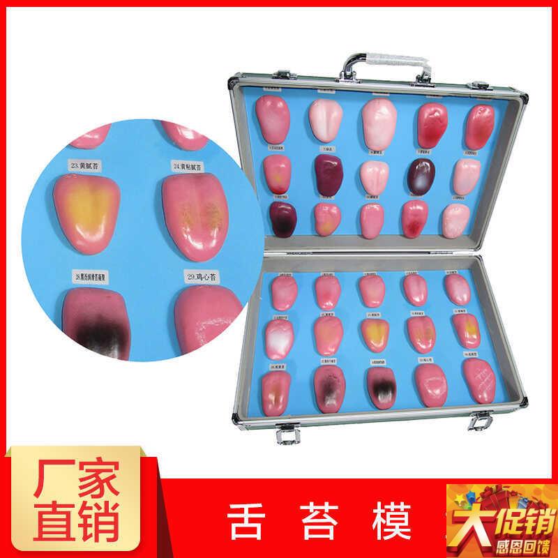 人体舌头舌苔模型常见病舌苔病变比较中医口腔S望诊教学解剖模型