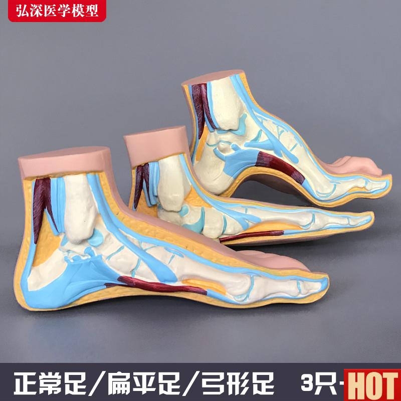 模型正常足扁平足弓型足解剖人体脚部P构结构造肌肉血管医学模具