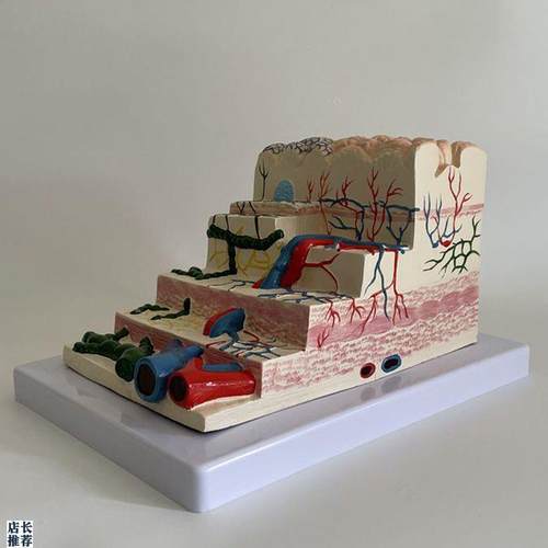 胃粘膜放大模型胃壁层次血管淋y巴管胃镜教学消化科医生示教医药