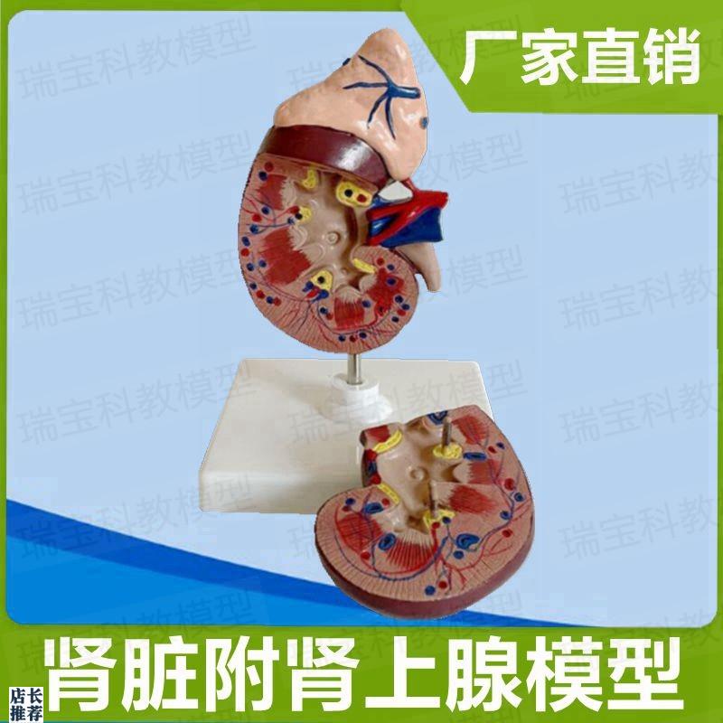 人体肾脏模型自然大可拆卸带肾上腺泌尿系统Q外科肾结构输尿管