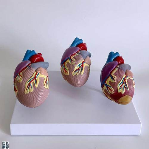 康泰模型人体心脏血管狭窄心房z室病理医药促销肥大二尖瓣主动脉