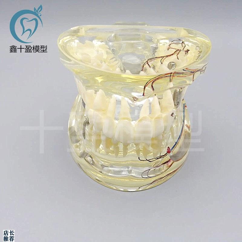牙科水晶牙齿病理模型Mq4019-2成人透明病理牙模型带牙神经和嵌体