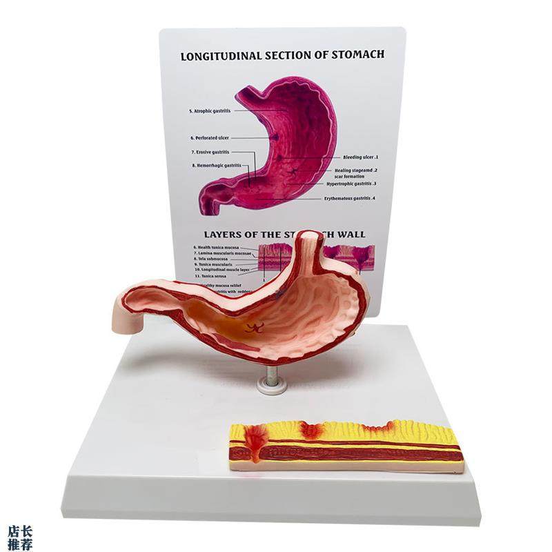 人体胃部消化系统n解剖模型内脏解剖胃炎教学医学教具厂家直销