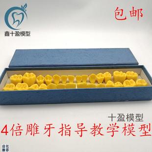 4倍标准雕刻牙齿模型口腔牙科教学对照模型雕牙顺序模型. D19 包邮
