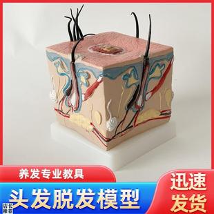 人体毛发b脱发模型头发头皮发炎毛细血管毛囊收缩教学教具演示模