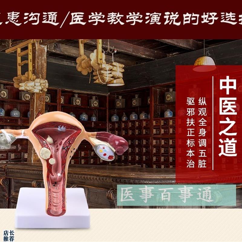 人体子宫a解剖模型子宫模型子宫癌变输卵管狭窄综合疾病科普教育