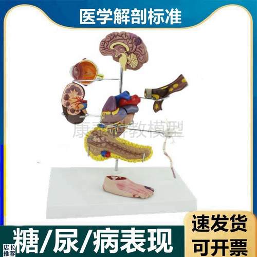 糖尿模型脏器受损病理内分泌w医患沟通眼底脑足心脏血管变化可拆