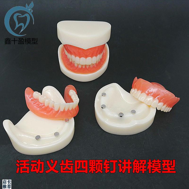 牙科模型活动义齿牙m模讲解模型全口义齿四颗钉教学模型T21包邮