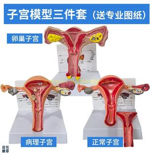 人体模型女性生殖子宫模型生殖卵巢模型教学模具T病理变化科学教