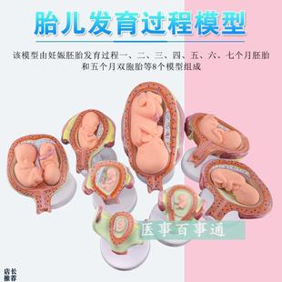 妊娠发育过程模型胚胎计划生育模型计生展示模T型胎儿模型子宫
