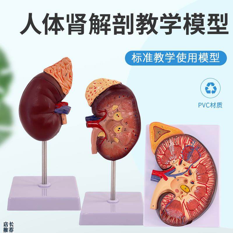 人体肾脏模型肾解剖附肾上腺放大模型病K变肾脏内脏器官解剖3倍