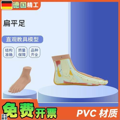 德国】PNT-0728扁平足直观B教具平底足弓塌陷模型脚关节解剖模