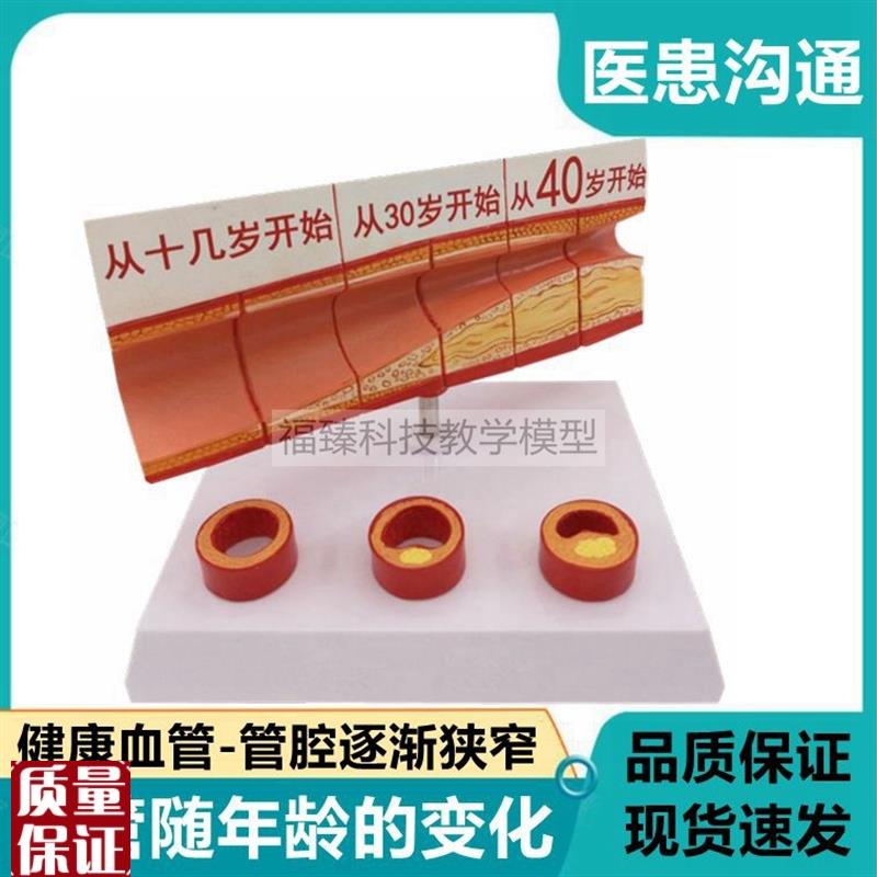 血管粥样脂肪f斑块动脉内膜不同年龄段血管变化栓破裂狭窄堵塞病
