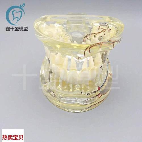 牙科水晶牙齿病理j模型M4019-2成人透明病理牙模型带牙神经和嵌体