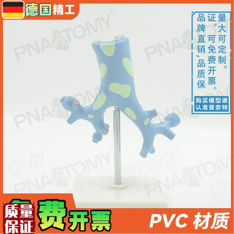 德国】新品人体呼吸系统v病理肺部支气管树解剖模型教学呼吸科