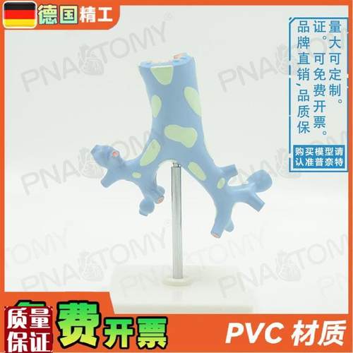 德国】新品人体呼吸系统v病理肺部支气管树解剖模型教学呼吸科