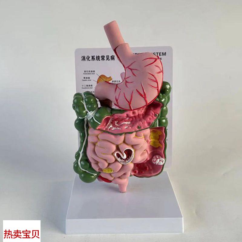 康泰医用模型g食管胃肠道病变桌上型医患示教消化道医药促销直播