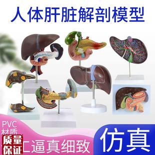 正品仿真人体肝脏k模型肝解剖肝胆胰脾十二指肠浮雕病变肝胆胰模