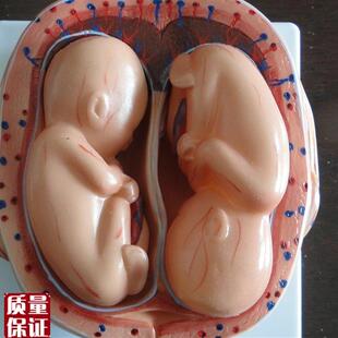 8件 妊娠胚胎模型 胎儿妊娠发育过程模型 怀孕胎D儿模型