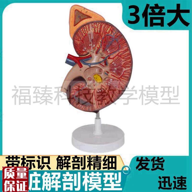 大型肾脏模型放大3倍带标识肾上腺肾小球蛋P白尿形成泌尿系病理
