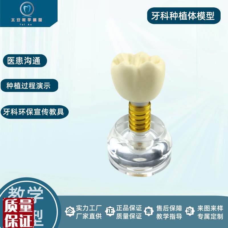 牙科口腔材料透明水晶w种植体模型螺丝可拆卸医患沟