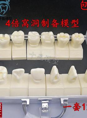 牙科4倍大窝洞制备模型四倍牙齿备牙标准示范嵌体洞型12Y个M702