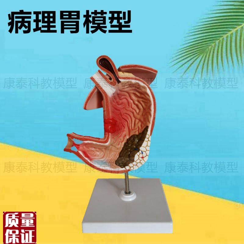病理胃模型c食管疝孔粘膜胃壁层次结构血管神经分布消化内脏医患